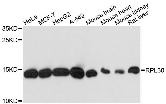 RPL30 / Ribosomal Protein L30 Antibody - Western blot analysis of extracts of various cell lines, using RPL30 antibody at 1:3000 dilution. The secondary antibody used was an HRP Goat Anti-Rabbit IgG (H+L) at 1:10000 dilution. Lysates were loaded 25ug per lane and 3% nonfat dry milk in TBST was used for blocking. An ECL Kit was used for detection and the exposure time was 10s.