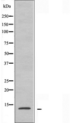 RPL30 / Ribosomal Protein L30 Antibody - Western blot analysis of extracts of A549 cells using RPL30 antibody.