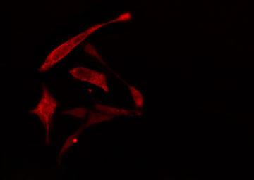 RPL30 / Ribosomal Protein L30 Antibody - Staining A549 cells by IF/ICC. The samples were fixed with PFA and permeabilized in 0.1% Triton X-100, then blocked in 10% serum for 45 min at 25°C. The primary antibody was diluted at 1:200 and incubated with the sample for 1 hour at 37°C. An Alexa Fluor 594 conjugated goat anti-rabbit IgG (H+L) antibody, diluted at 1/600, was used as secondary antibody.
