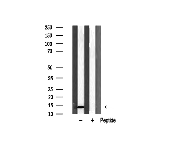 RPL31 / Ribosomal Protein L31 Antibody - Western blot analysis of RPL31 antibody expression in rat spleen tissue lysates. The lane on the right is treated with the antigen-specific peptide.