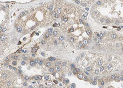 RPL31 / Ribosomal Protein L31 Antibody - 1:100 staining human kidney tissue by IHC-P. The tissue was formaldehyde fixed and a heat mediated antigen retrieval step in citrate buffer was performed. The tissue was then blocked and incubated with the antibody for 1.5 hours at 22°C. An HRP conjugated goat anti-rabbit antibody was used as the secondary.