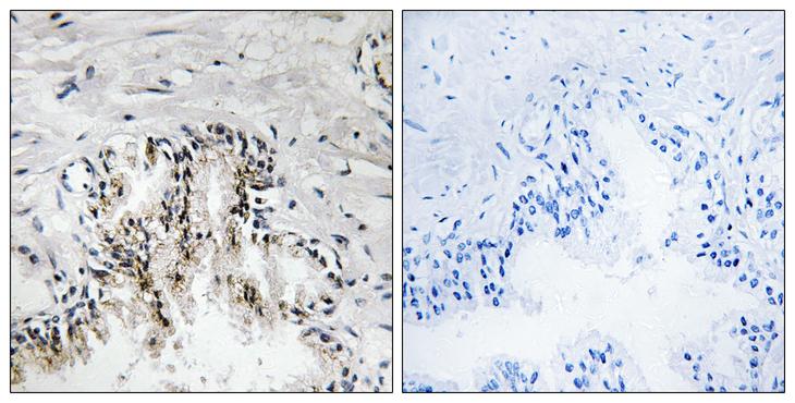RPL31 / Ribosomal Protein L31 Antibody - Peptide - + Immunohistochemistry analysis of paraffin-embedded human prostate tissue using RPL31 antibody.
