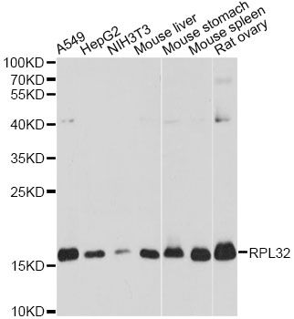 RPL32 / Ribosomal Protein L32 Antibody - Western blot analysis of extracts of various cell lines, using RPL32 antibody at 1:3000 dilution. The secondary antibody used was an HRP Goat Anti-Rabbit IgG (H+L) at 1:10000 dilution. Lysates were loaded 25ug per lane and 3% nonfat dry milk in TBST was used for blocking. An ECL Kit was used for detection and the exposure time was 1s.