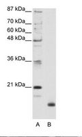 RPL32 / Ribosomal Protein L32 Antibody - A: Marker, B: HepG2 Cell Lysate.  This image was taken for the unconjugated form of this product. Other forms have not been tested.
