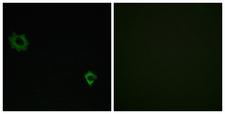 RPL34 / Ribosomal Protein L34 Antibody - Immunofluorescence analysis of HUVEC cells, using RPL34 Antibody. The picture on the right is blocked with the synthesized peptide.