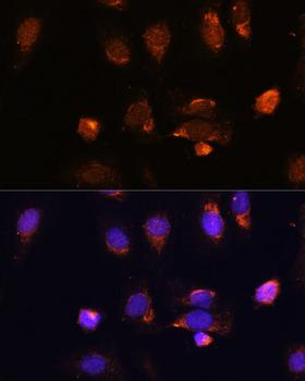 RPL34 / Ribosomal Protein L34 Antibody - Immunofluorescence analysis of U-2OS cells using RPL34 Polyclonal Antibody at dilution of 1:100.Blue: DAPI for nuclear staining.