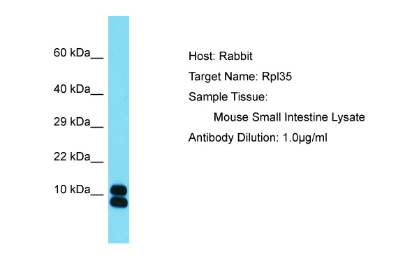 RPL35 / Ribosomal Protein L35 Antibody -  This image was taken for the unconjugated form of this product. Other forms have not been tested.