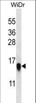 RPL35 / Ribosomal Protein L35 Antibody - RPL35 Antibody western blot of WiDr cell line lysates (35 ug/lane). The RPL35 antibody detected the RPL35 protein (arrow).