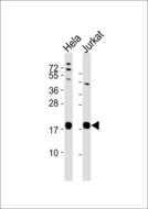 RPL35 / Ribosomal Protein L35 Antibody - All lanes : Anti-RPL35 Antibody at 1:1000 dilution Lane 1: HeLa whole cell lysates Lane 2: Jurkat whole cell lysates Lysates/proteins at 20 ug per lane. Secondary Goat Anti-Rabbit IgG, (H+L),Peroxidase conjugated at 1/10000 dilution Predicted band size : 15 kDa Blocking/Dilution buffer: 5% NFDM/TBST.