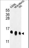 RPL36 / Ribosomal Protein L36 Antibody - Western blot of RPL36 Antibody in A2058, MDA-MB435, 293 cell line lysates (35 ug/lane). RPL36 (arrow) was detected using the purified antibody.
