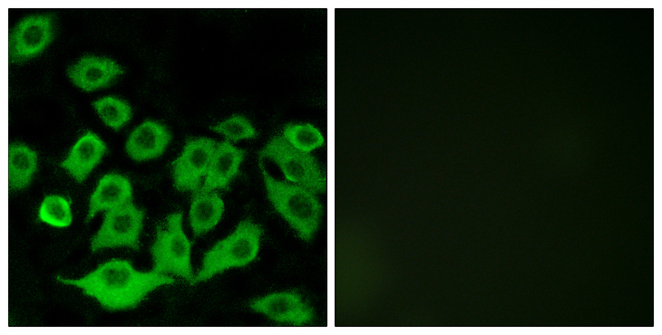 RPL36 / Ribosomal Protein L36 Antibody - Immunofluorescence analysis of A549 cells, using RPL36 Antibody. The picture on the right is blocked with the synthesized peptide.