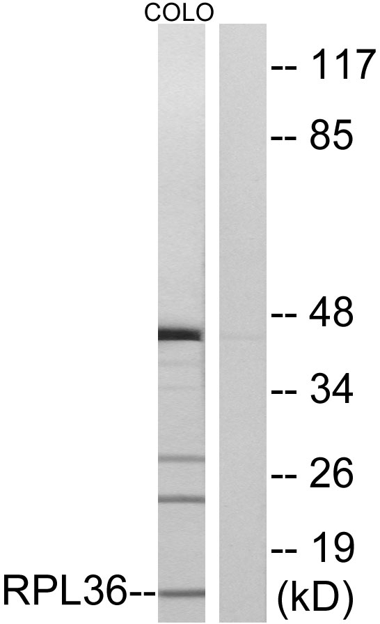 RPL36 / Ribosomal Protein L36 Antibody - Western blot analysis of lysates from COLO cells, using RPL36 Antibody. The lane on the right is blocked with the synthesized peptide.