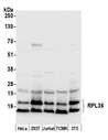 RPL36 / Ribosomal Protein L36 Antibody - Detection of human and mouse RPL36 by western blot. Samples: Whole cell lysate (50 µg) from HeLa, HEK293T, Jurkat, mouse TCMK-1, and mouse NIH 3T3 cells prepared using NETN lysis buffer. Antibody: Affinity purified rabbit anti-RPL36 antibody used for WB at 0.04 µg/ml. Detection: Chemiluminescence with an exposure time of 1 second.
