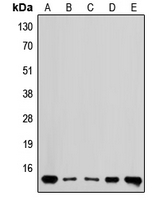 RPL36 / Ribosomal Protein L36 Antibody - Western blot analysis of RPL36 expression in MDAMB435 (A); HEK293 (B); Raw264.7 (C); mouse brain (D); rat brain (E) whole cell lysates.