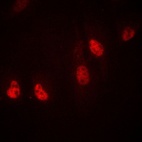 RPL36 / Ribosomal Protein L36 Antibody - Immunofluorescent analysis of RPL36 staining in MDAMB435 cells. Formalin-fixed cells were permeabilized with 0.1% Triton X-100 in TBS for 5-10 minutes and blocked with 3% BSA-PBS for 30 minutes at room temperature. Cells were probed with the primary antibody in 3% BSA-PBS and incubated overnight at 4 C in a humidified chamber. Cells were washed with PBST and incubated with a DyLight 594-conjugated secondary antibody (red) in PBS at room temperature in the dark. DAPI was used to stain the cell nuclei (blue).