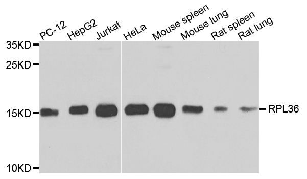 RPL36 / Ribosomal Protein L36 Antibody - Western blot analysis of extracts of various cells.