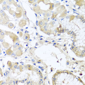 RPL36 / Ribosomal Protein L36 Antibody - Immunohistochemistry of paraffin-embedded human stomach tissue.