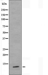 RPL36 / Ribosomal Protein L36 Antibody - Western blot analysis of extracts of COLO cells using RPL36 antibody.