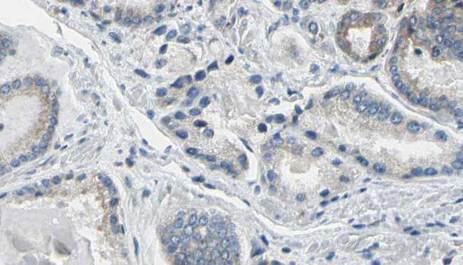RPL36 / Ribosomal Protein L36 Antibody - 1:100 staining human prostate tissue by IHC-P. The sample was formaldehyde fixed and a heat mediated antigen retrieval step in citrate buffer was performed. The sample was then blocked and incubated with the antibody for 1.5 hours at 22°C. An HRP conjugated goat anti-rabbit antibody was used as the secondary.