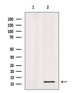RPL36 / Ribosomal Protein L36 Antibody - Western blot analysis of extracts of HepG2 cells using RPL36 antibody. Lane 1 was treated with the blocking peptide.