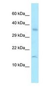 RPL36A / Ribosomal Protein L36 Antibody - RPL36A / MIG6 antibody Western Blot of HT1080.  This image was taken for the unconjugated form of this product. Other forms have not been tested.