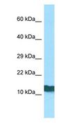 RPL36AL Antibody - RPL36AL antibody Western Blot of Jurkat.  This image was taken for the unconjugated form of this product. Other forms have not been tested.