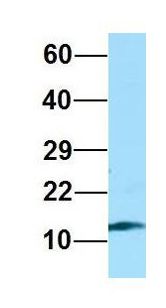 RPL36AL Antibody - RPL36AL antibody Western Blot of Human Placenta. Antibody Dilution: 1.0 ug/ml. Antibody dilution: 1 ug/ml.  This image was taken for the unconjugated form of this product. Other forms have not been tested.