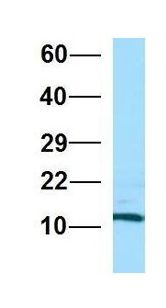 RPL36AL Antibody - RPL36AL antibody Western Blot of Human Fetal Brain. Antibody Dilution: 1.0ug/ml. Antibody dilution: 1 ug/ml.  This image was taken for the unconjugated form of this product. Other forms have not been tested.
