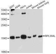 RPL36AL Antibody - Western blot analysis of extracts of various cell lines, using RPL36AL antibody at 1:1000 dilution. The secondary antibody used was an HRP Goat Anti-Rabbit IgG (H+L) at 1:10000 dilution. Lysates were loaded 25ug per lane and 3% nonfat dry milk in TBST was used for blocking. An ECL Kit was used for detection and the exposure time was 90s.