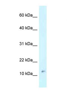 RPL37 / Ribosomal Protein L37 Antibody - RPL37 antibody Western blot of MCF7 Cell lysate. Antibody concentration 1 ug/ml.  This image was taken for the unconjugated form of this product. Other forms have not been tested.
