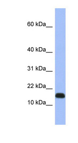 RPL37A Antibody - RPL37A antibody Western blot of Fetal Heart lysate. This image was taken for the unconjugated form of this product. Other forms have not been tested.