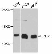 RPL38 / Ribosomal Protein L38 Antibody - Western blot analysis of extracts of various cell lines, using RPL38 antibody at 1:3000 dilution. The secondary antibody used was an HRP Goat Anti-Rabbit IgG (H+L) at 1:10000 dilution. Lysates were loaded 25ug per lane and 3% nonfat dry milk in TBST was used for blocking. An ECL Kit was used for detection and the exposure time was 30s.