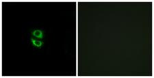 RPL39 / Ribosomal Protein L39 Antibody - Immunofluorescence analysis of A549 cells, using RPL39 Antibody. The picture on the right is blocked with the synthesized peptide.