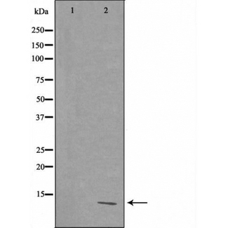 RPL39 / Ribosomal Protein L39 Antibody - Western blot analysis of extracts of HepG2 cells using RPL39 antibody. The lane on the left is treated with the antigen-specific peptide.