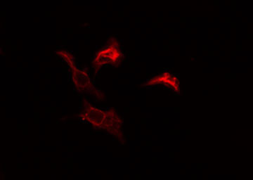RPL39 / Ribosomal Protein L39 Antibody - Staining COLO205 cells by IF/ICC. The samples were fixed with PFA and permeabilized in 0.1% Triton X-100, then blocked in 10% serum for 45 min at 25°C. The primary antibody was diluted at 1:200 and incubated with the sample for 1 hour at 37°C. An Alexa Fluor 594 conjugated goat anti-rabbit IgG (H+L) antibody, diluted at 1/600, was used as secondary antibody.