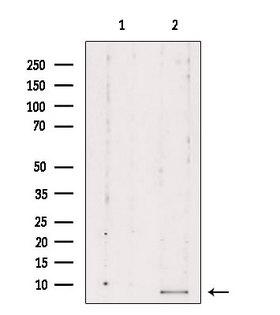 RPL39 / Ribosomal Protein L39 Antibody - Western blot analysis of extracts of mouse carcinoma using RPL39 antibody. Lane 1 was treated with the blocking peptide.