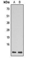 RPL39 / Ribosomal Protein L39 Antibody - Western blot analysis of RPL39 expression in HL60 (A); HepG2 (B) whole cell lysates.