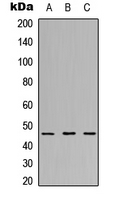 RPL3L Antibody - Western blot analysis of RPL3L expression in MCF7 (A); NS-1 (B); PC12 (C) whole cell lysates.