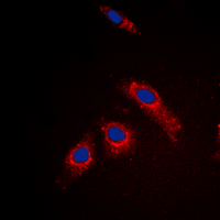 RPL3L Antibody - Immunofluorescent analysis of RPL3L staining in MCF7 cells. Formalin-fixed cells were permeabilized with 0.1% Triton X-100 in TBS for 5-10 minutes and blocked with 3% BSA-PBS for 30 minutes at room temperature. Cells were probed with the primary antibody in 3% BSA-PBS and incubated overnight at 4 C in a humidified chamber. Cells were washed with PBST and incubated with a DyLight 594-conjugated secondary antibody (red) in PBS at room temperature in the dark. DAPI was used to stain the cell nuclei (blue).