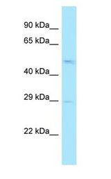 RPL4 / Ribosomal Protein L4 Antibody - RPL4 / L4 antibody Western Blot of OVCAR-3.  This image was taken for the unconjugated form of this product. Other forms have not been tested.