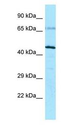 RPL4 / Ribosomal Protein L4 Antibody - RPL4 / L4 antibody Western Blot of MCF7.  This image was taken for the unconjugated form of this product. Other forms have not been tested.