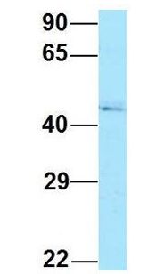 RPL4 / Ribosomal Protein L4 Antibody - RPL4 / L4 antibody Western Blot of Human 721_B lysate. Antibody Dilution: 1.0 ug/ml. RPL4 is strongly supported by BioGPS gene expression data to be expressed in Human 721_B cells. Antibody dilution: 1 ug/ml.  This image was taken for the unconjugated form of this product. Other forms have not been tested.