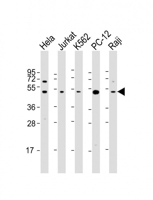 RPL4 / Ribosomal Protein L4 Antibody - All lanes: Anti-RPL4 Antibody (C-Term) at 1:2000 dilution Lane 1: Hela whole cell lysate Lane 2: Jurkat whole cell lysate Lane 3: K562 whole cell lysate Lane 4: PC-12 whole cell lysate Lane 5: Raji whole cell lysate Lysates/proteins at 20 µg per lane. Secondary Goat Anti-Rabbit IgG, (H+L), Peroxidase conjugated at 1/10000 dilution. Predicted band size: 48 kDa Blocking/Dilution buffer: 5% NFDM/TBST.