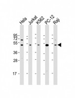 RPL4 / Ribosomal Protein L4 Antibody - All lanes: Anti-RPL4 Antibody (C-Term) at 1:2000 dilution Lane 1: Hela whole cell lysate Lane 2: Jurkat whole cell lysate Lane 3: K562 whole cell lysate Lane 4: PC-12 whole cell lysate Lane 5: Raji whole cell lysate Lysates/proteins at 20 µg per lane. Secondary Goat Anti-Rabbit IgG, (H+L), Peroxidase conjugated at 1/10000 dilution. Predicted band size: 48 kDa Blocking/Dilution buffer: 5% NFDM/TBST.