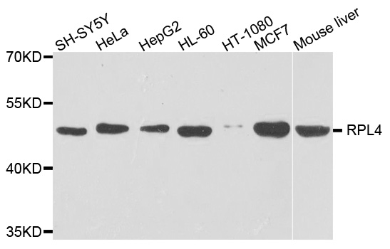 RPL4 / Ribosomal Protein L4 Antibody - Western blot analysis of extracts of various cells.