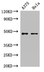 RPL4 / Ribosomal Protein L4 Antibody - Positive WB detected in:A375 whole cell lysate,Hela whole cell lysate;All lanes:RPL4 antibody at 2?g/ml;Secondary;Goat polyclonal to rabbit IgG at 1/50000 dilution;Predicted band size: 48 KDa;Observed band size: 48 KDa;