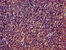 RPL4 / Ribosomal Protein L4 Antibody - Immunohistochemistry of paraffin-embedded human lymph node tissue using RPL4 Antibody at dilution of 1:100