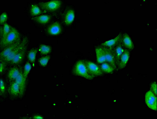 RPL4 / Ribosomal Protein L4 Antibody - Immunofluorescent analysis of HepG2 cells using RPL4 Antibody at a dilution of 1:100 and Alexa Fluor 488-congugated AffiniPure Goat Anti-Rabbit IgG(H+L)