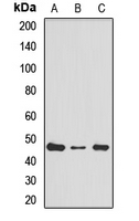 RPL4 / Ribosomal Protein L4 Antibody