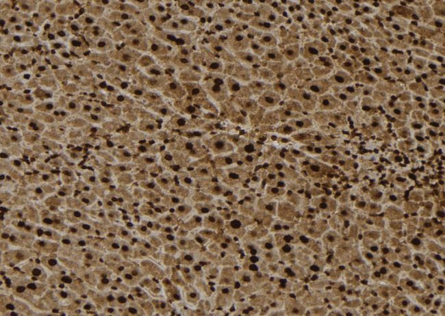 RPL4 / Ribosomal Protein L4 Antibody - 1:100 staining mouse liver tissue by IHC-P. The sample was formaldehyde fixed and a heat mediated antigen retrieval step in citrate buffer was performed. The sample was then blocked and incubated with the antibody for 1.5 hours at 22°C. An HRP conjugated goat anti-rabbit antibody was used as the secondary.